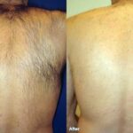 before and after 4 orig